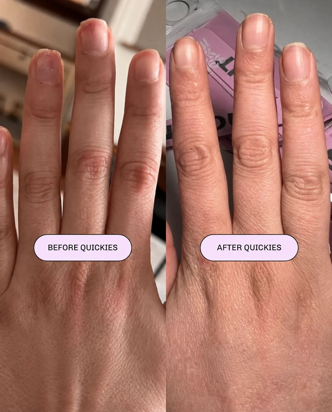 Natural nails before and after Quickies